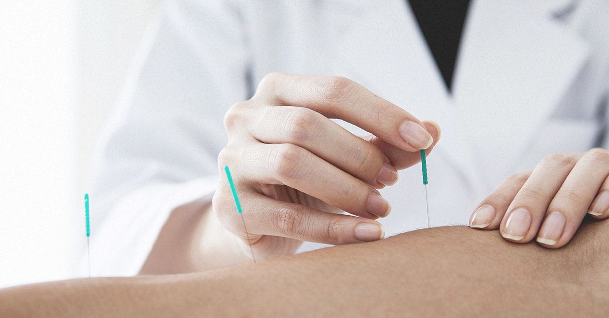 Acupuncture Melbourne