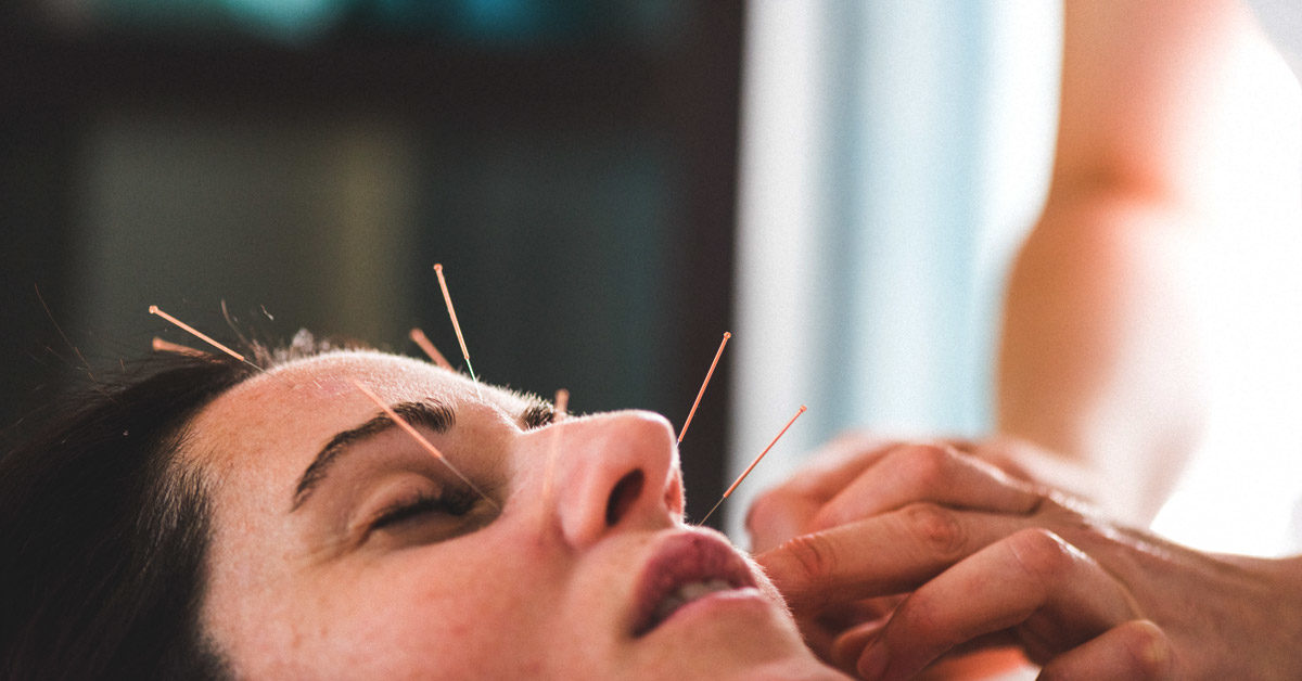 Acupuncturist Melbourne