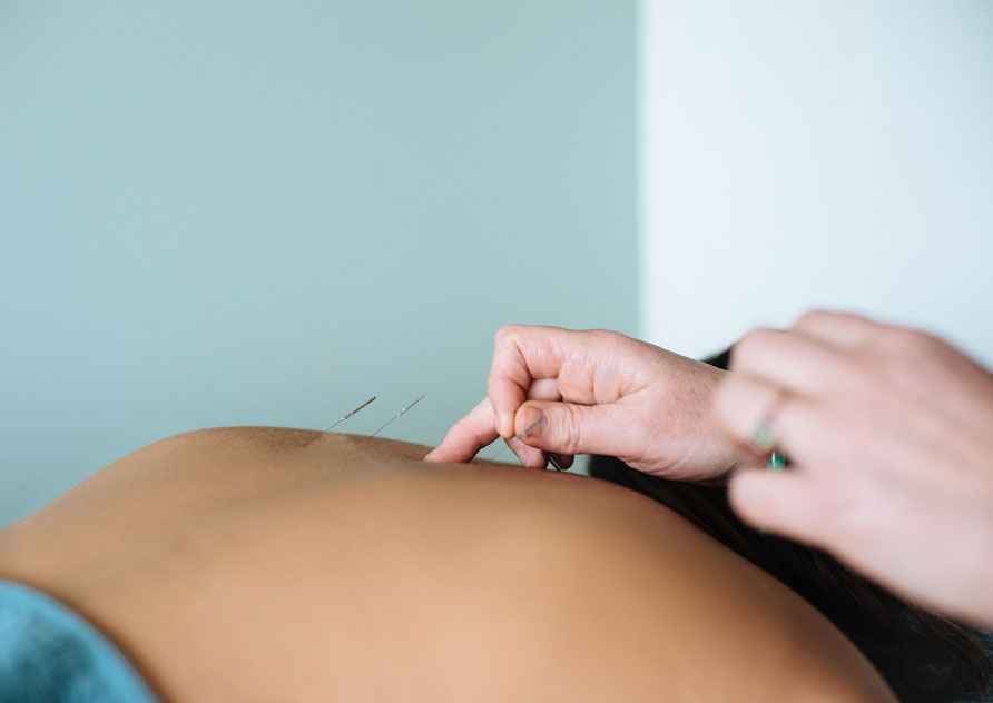 acupuncturist