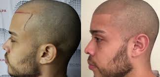 hair tattoo