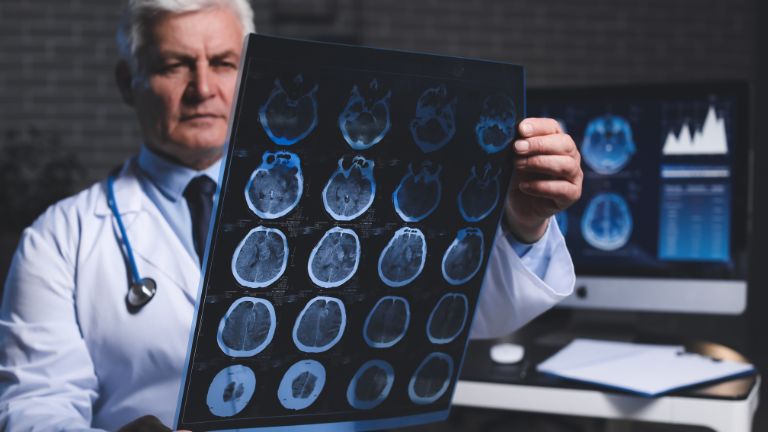best neurologist Melbourne